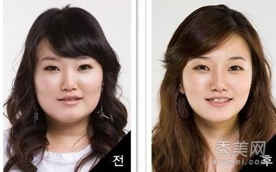 整形全纪录:韩国女人整容前后(图)-ZOL技术频道